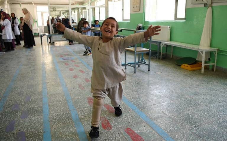 Storia di Ahmad, il bimbo che balla con la protesi che ha commosso il mondo