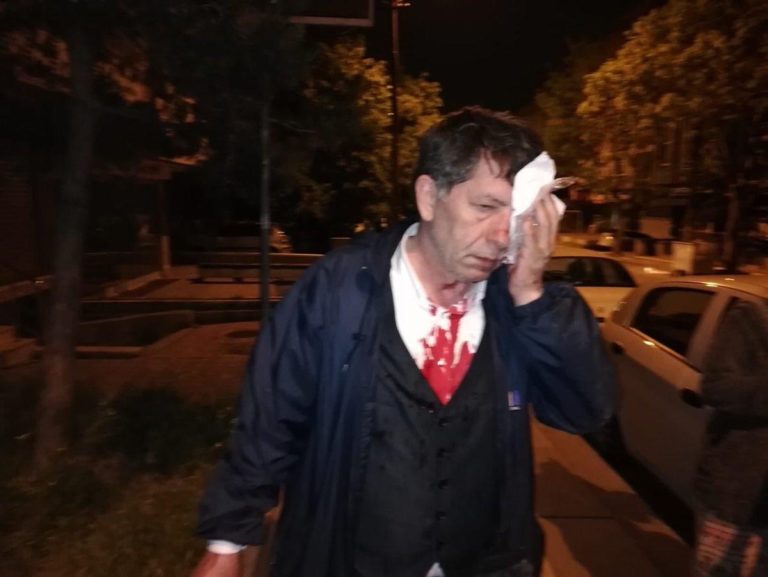 Turchia, editorialista e scrittore turco aggredito sotto casa mentre altri tre giornalisti finiscono in carcere