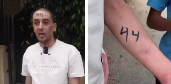 Perché imitate i nazisti anche con i numeri sui corpi? – Lettera aperta all’Ambasciatore di Israele
